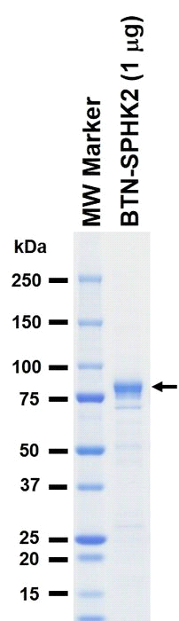 The purity was assessed by SDS-PAGE/CBB staining.